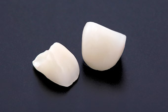 ジルコニアオールセラミックス