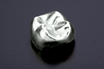 銀歯(保険適用)